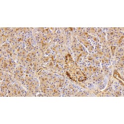 Fibronectin (FN) Antibody