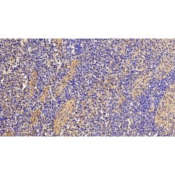 Fibronectin (FN) Antibody