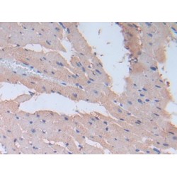 Fibronectin (FN) Antibody