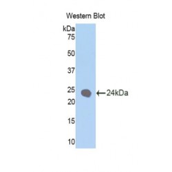 Keratin 1 (KRT1) Antibody