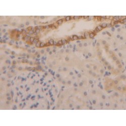 Keratin 1 (KRT1) Antibody