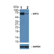 Western blot analysis of (1) Wild-type A431 cell lysate, and (2) KRT2 knockout A431 cell lysate, using Rabbit Anti-Rat KRT2 Antibody (1 µg/ml) and HRP-conjugated Goat Anti-Mouse antibody (<a href="https://www.abbexa.com/index.php?route=product/search&amp;search=abx400001" target="_blank">abx400001</a>, 0.2 µg/ml).