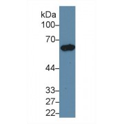 Western blot analysis of Rat Ovary lysate, using Rat KRT5 Antibody (1 µg/ml) and HRP-conjugated Goat Anti-Rabbit antibody (<a href="https://www.abbexa.com/index.php?route=product/search&amp;search=abx400043" target="_blank">abx400043</a>, 0.2 µg/ml).