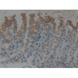 Keratin 5 (KRT5) Antibody