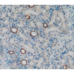 Keratin 5 (KRT5) Antibody