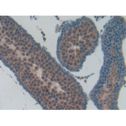 Osteocalcin (BGLAP) Antibody