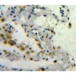 Osteonectin (ON) Antibody