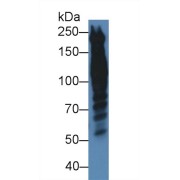 Western blot analysis of Human HeLa cell lysate, using Human PPL Antibody (5 µg/ml) and HRP-conjugated Goat Anti-Rabbit antibody (<a href="https://www.abbexa.com/index.php?route=product/search&amp;search=abx400043" target="_blank">abx400043</a>, 0.2 µg/ml).