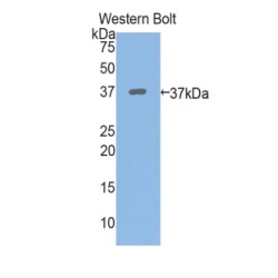 Periplakin (PPL) Antibody