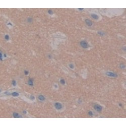 Periplakin (PPL) Antibody