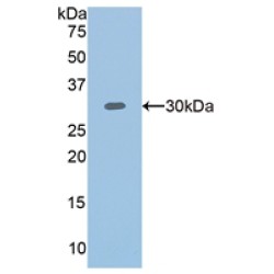 Plastin 3 (PLS3) Antibody