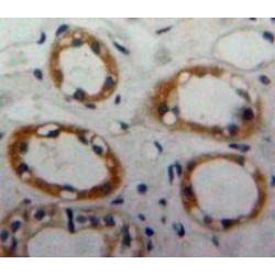 CD59 Glycoprotein (CD59) Antibody