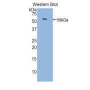 Western blot analysis of recombinant Rat PROS Protein (with N-terminal His and GST tags).