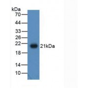 Western blot analysis of recombinant Human ADP.