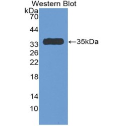 Antithrombin (AT) Antibody