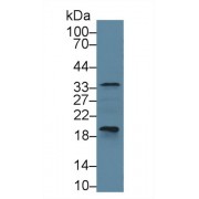 Western blot analysis of Cow Pancreas lysate, using Cow CASP6 Antibody (1 µg/ml) and HRP-conjugated Goat Anti-Rabbit antibody (<a href="https://www.abbexa.com/index.php?route=product/search&amp;search=abx400043" target="_blank">abx400043</a>, 0.2 µg/ml).