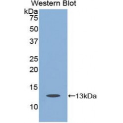 Caspase 6 (CASP6) Antibody