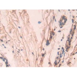 Caspase 7 (CASP7) Antibody