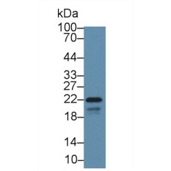 Caveolin 1 (CAV1) Antibody