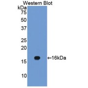 Western blot analysis of recombinant Human CAV1 Protein.