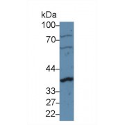 Western blot analysis of Human U87MG cell lysate, using Rat CCND1 Antibody (5 µg/ml) and HRP-conjugated Goat Anti-Rabbit antibody (<a href="https://www.abbexa.com/index.php?route=product/search&amp;search=abx400043" target="_blank">abx400043</a>, 0.2 µg/ml).