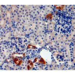 Cystatin A (CSTA) Antibody