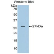 Western blot analysis of the recombinant protein.