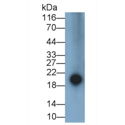 Epiregulin (EREG) Antibody