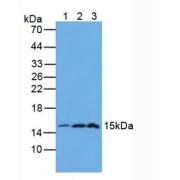 Western blot analysis of (1) Mouse Pancreas Tissue, (2) Mouse Intestine Tissue and (3) Mouse Stomach Tissue.