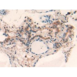 Galectin 2 (LGALS2) Antibody