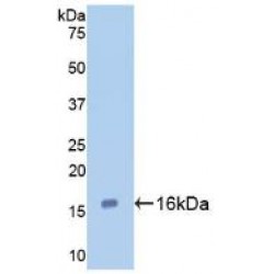 Galectin 7 (LGALS7) Antibody