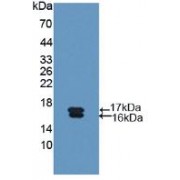 Western blot analysis of recombinant Human Glycocalicin.