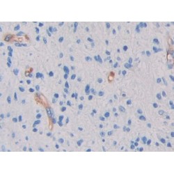 Glycocalicin (GC) Antibody