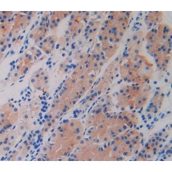 Glycocalicin (GC) Antibody