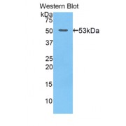 Western blot analysis of recombinant Mouse GZMB.