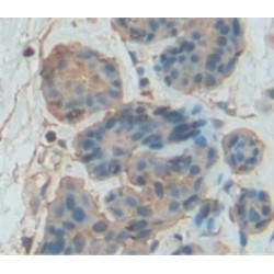 Granzyme B (GZMB) Antibody