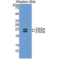 Haptoglobin Beta Chain (HP) Antibody