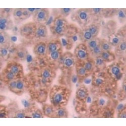 Haptoglobin Beta Chain (HP) Antibody