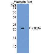 Western blot analysis of the recombinant protein.