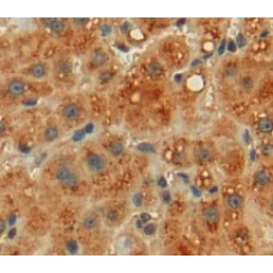 Haptoglobin Beta Chain (HP) Antibody