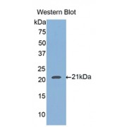 Western blot analysis of the recombinant protein.