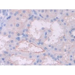 Hemojuvelin (HJV) Antibody