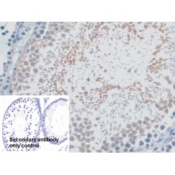 Myosin ID (MYO1D) Antibody