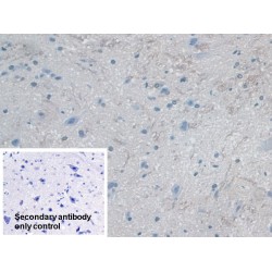 Myosin ID (MYO1D) Antibody