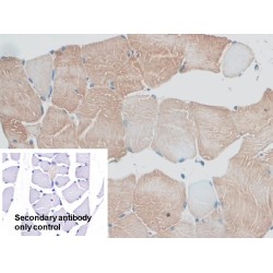 Myosin ID (MYO1D) Antibody