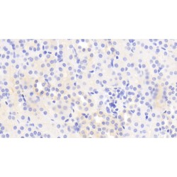 Myosin IE (MYO1E) Antibody