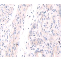 Osteoglycin (OGN) Antibody