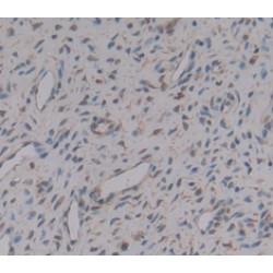 Osteoglycin (OGN) Antibody