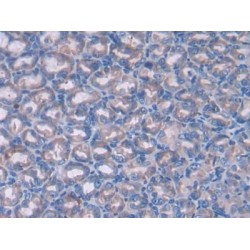 Patched 1 (PTCH1) Antibody