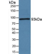 Western blot analysis of Human Serum using Periostin (POSTN) Antibody.